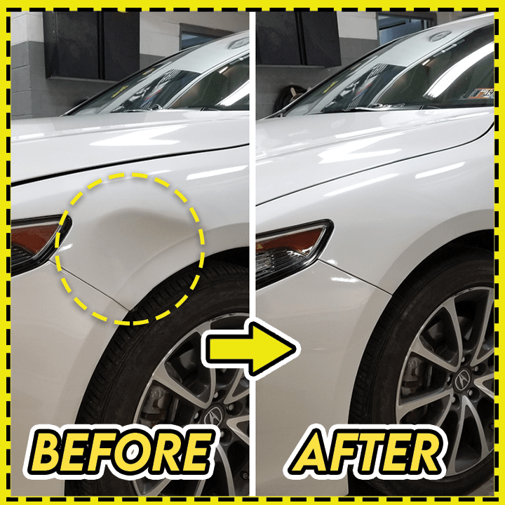 🔥Car Body Dents-Remover Puller Cups